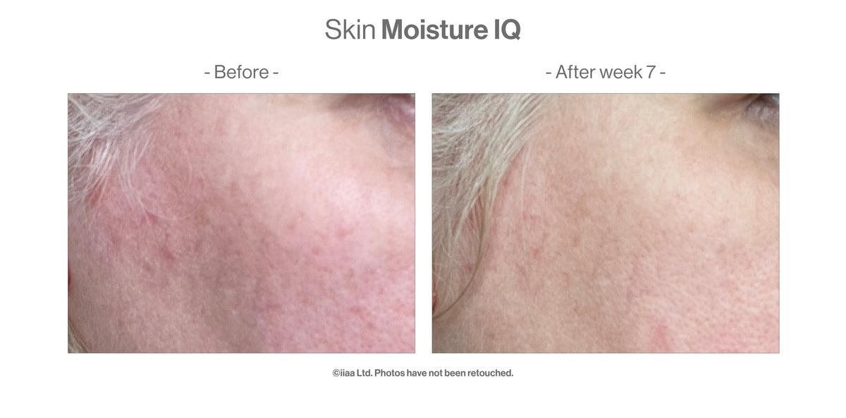 Skin MoistureIQ