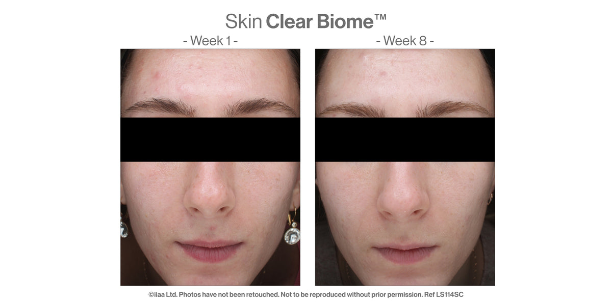 Skin Clear Biome™