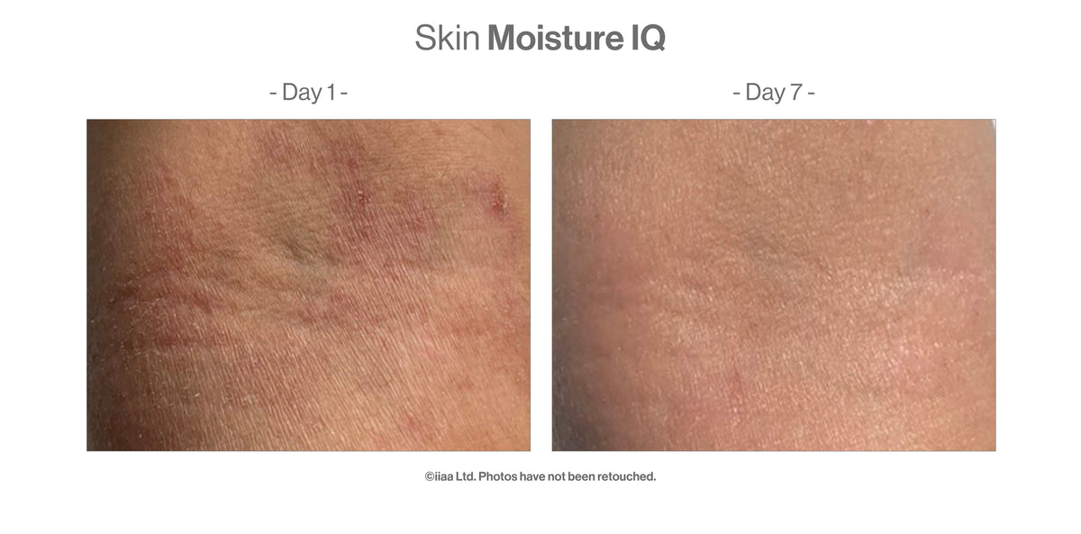 Skin MoistureIQ