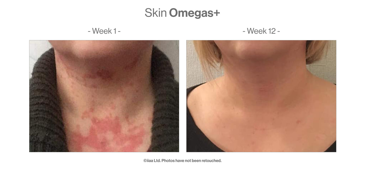 Skin Omegas+