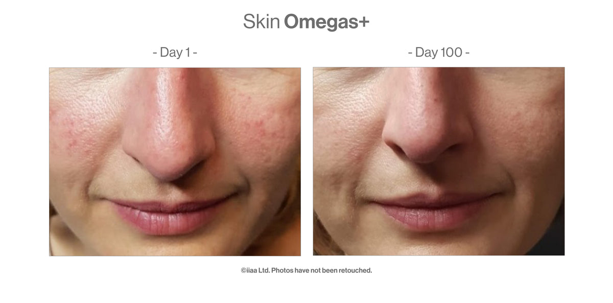 Skin Omegas+