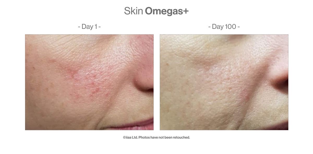 Skin Omegas+