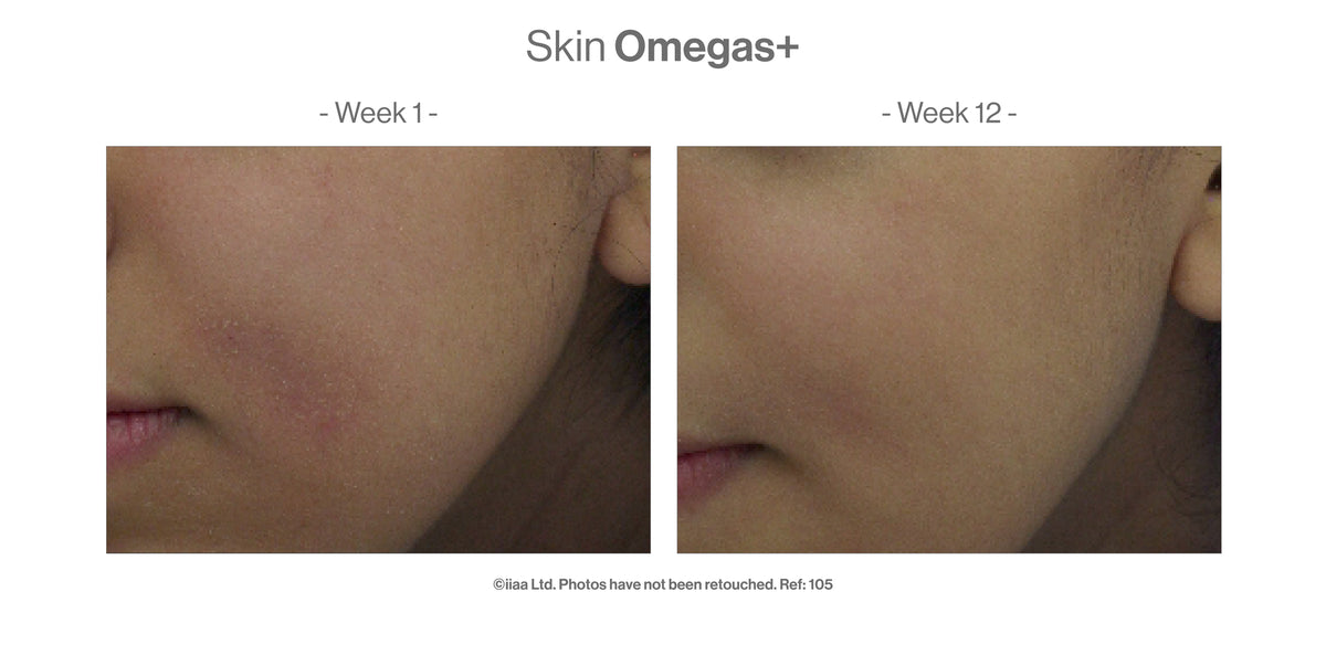 Skin Omegas+