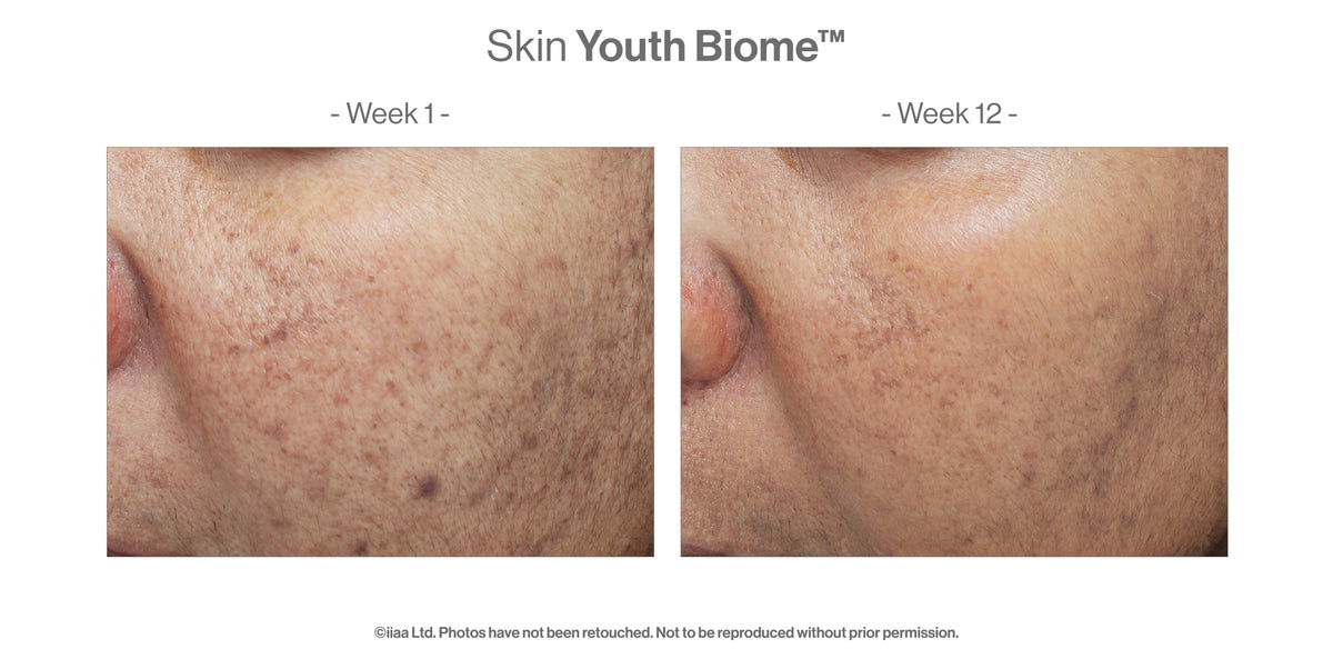 Skin Youth Biome™