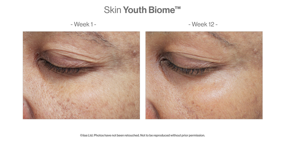 Skin Youth Biome™