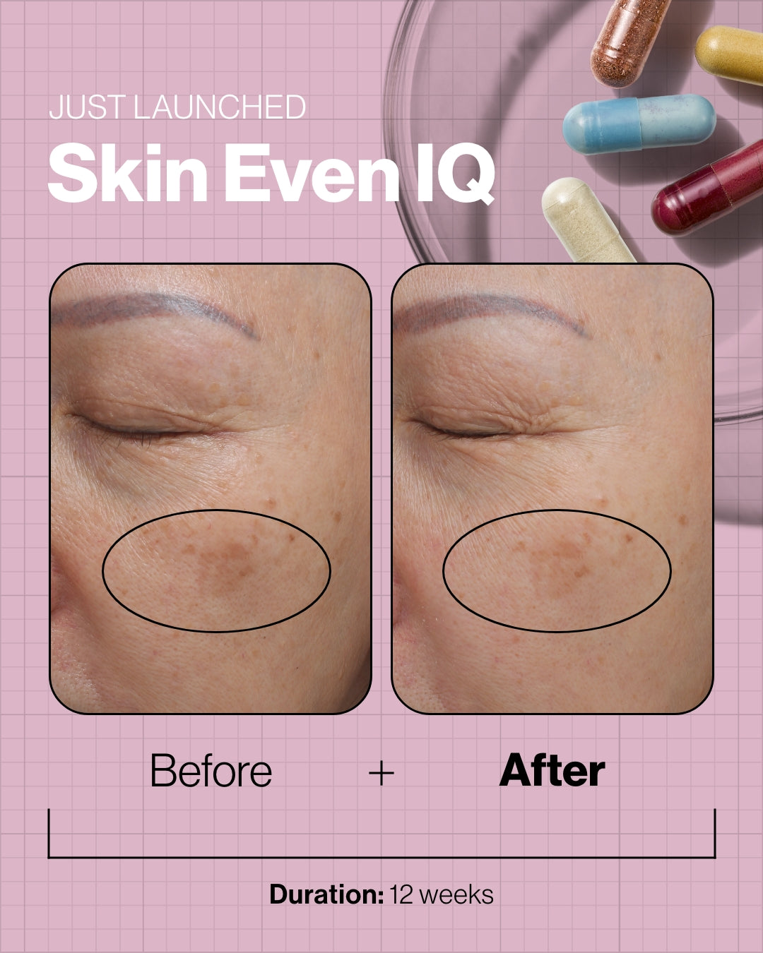 Skin Even IQ