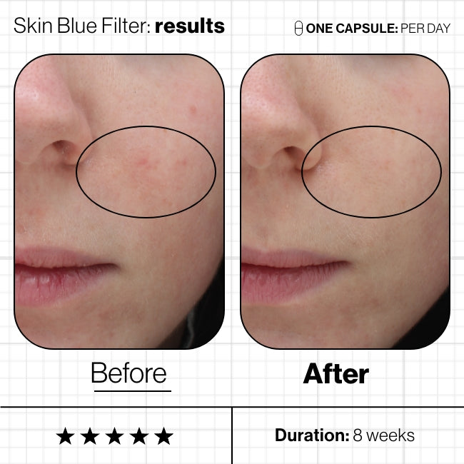 Skin Blue Filter
