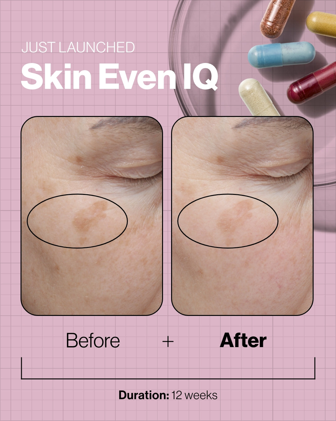 Skin Even IQ