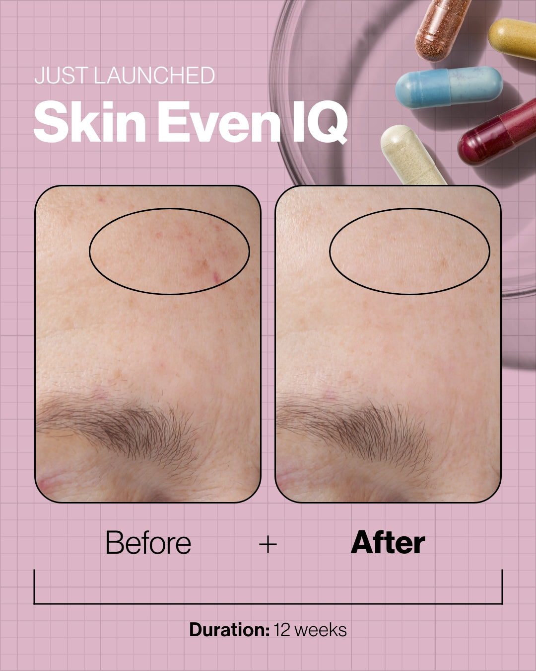 Skin Even IQ