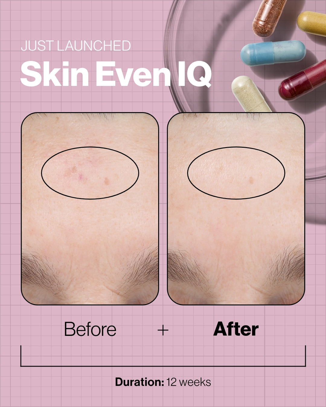 Skin Even IQ