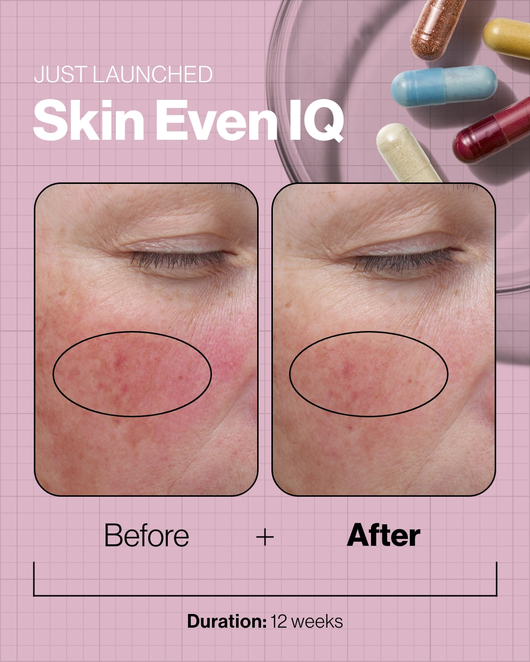 Skin Even IQ