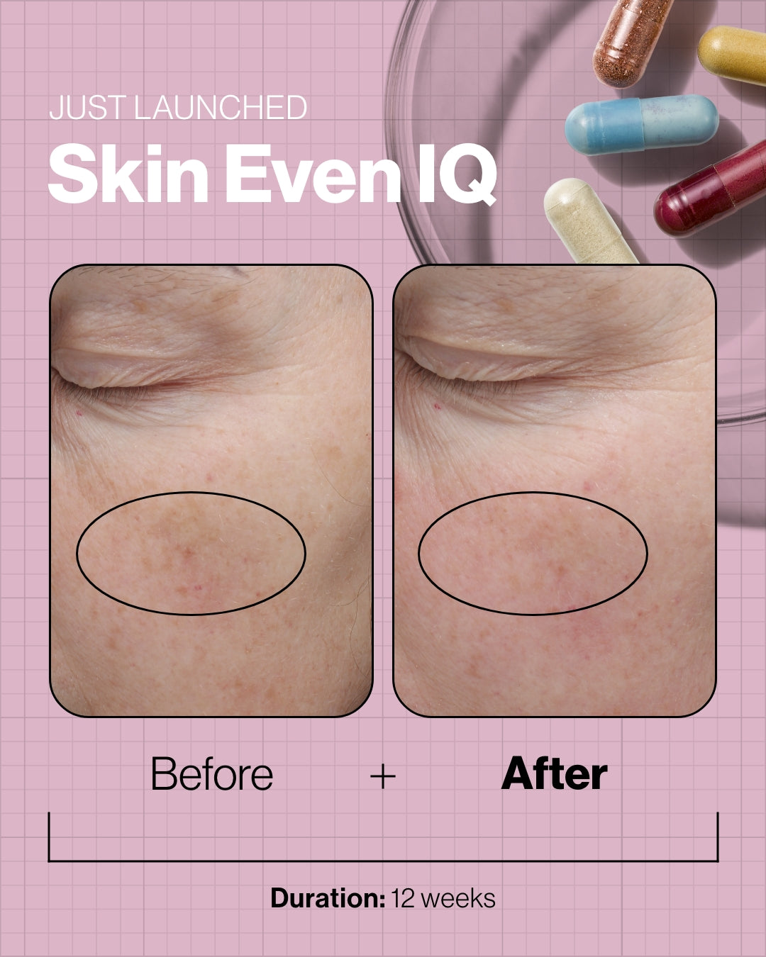 Skin Even IQ