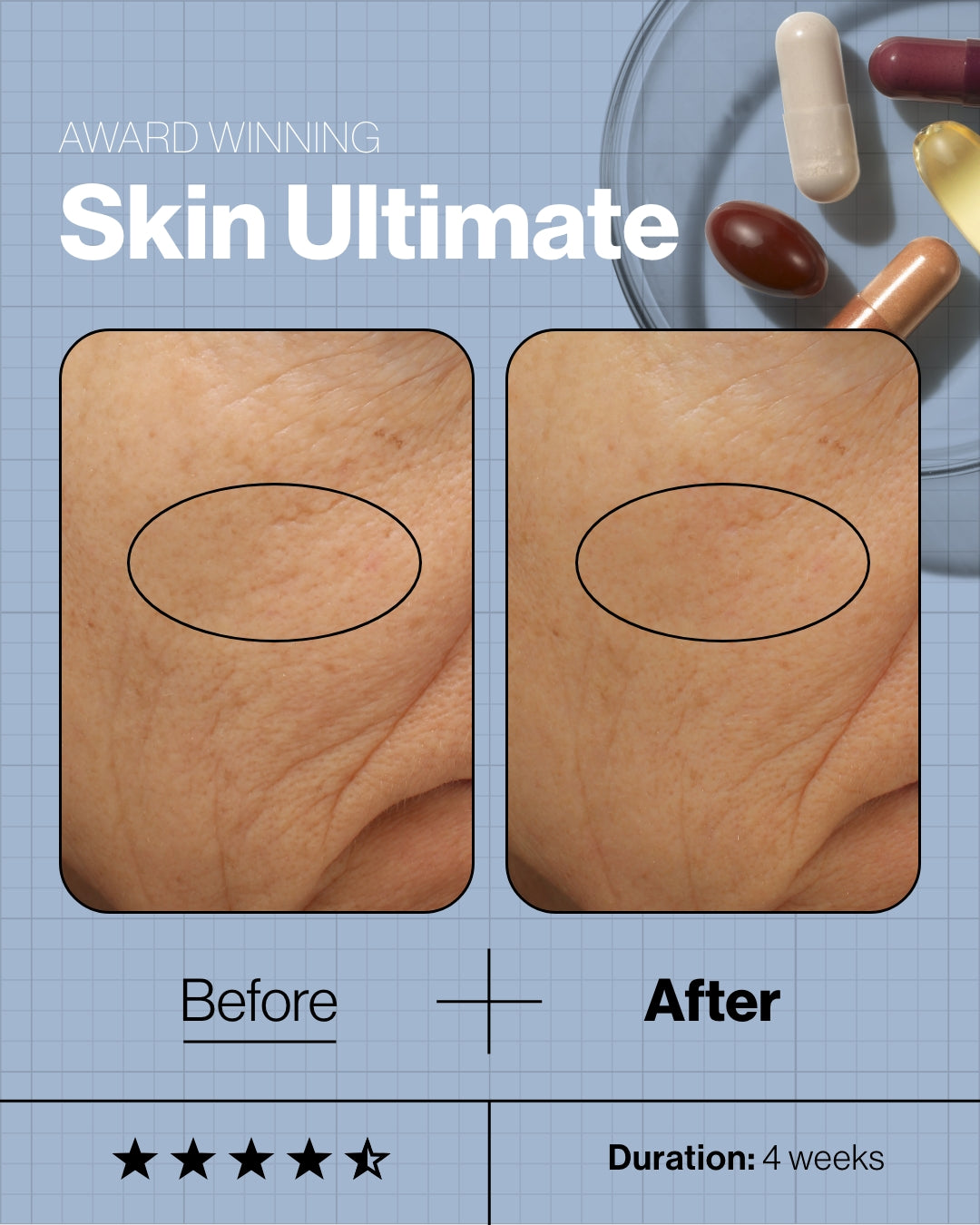 Skin Ultimate