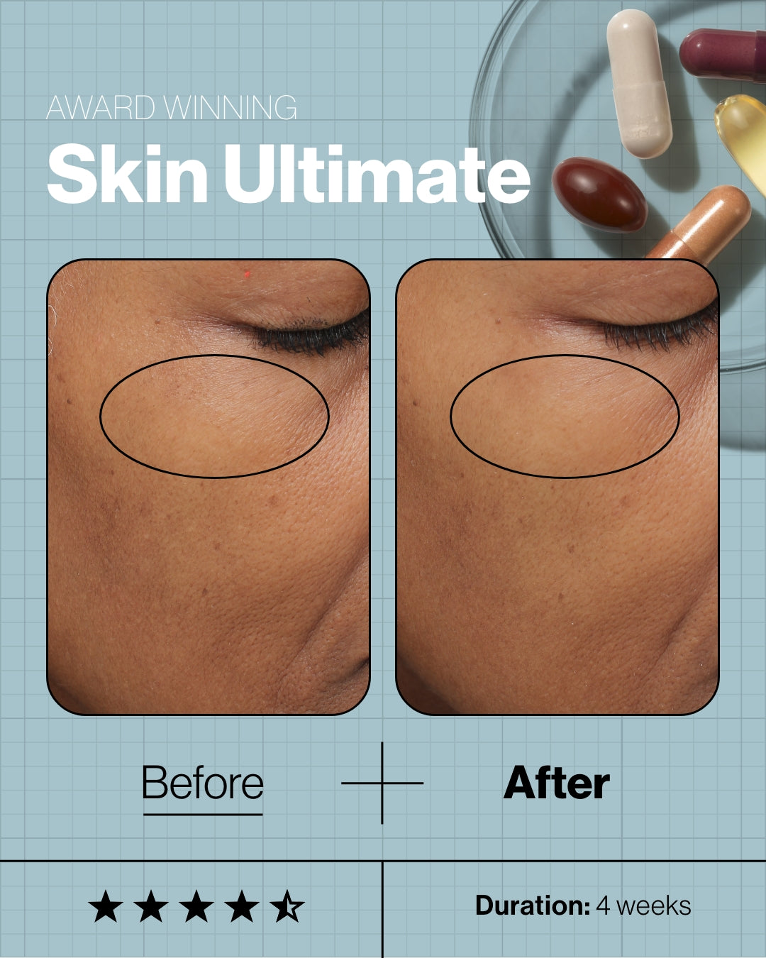 Skin Ultimate