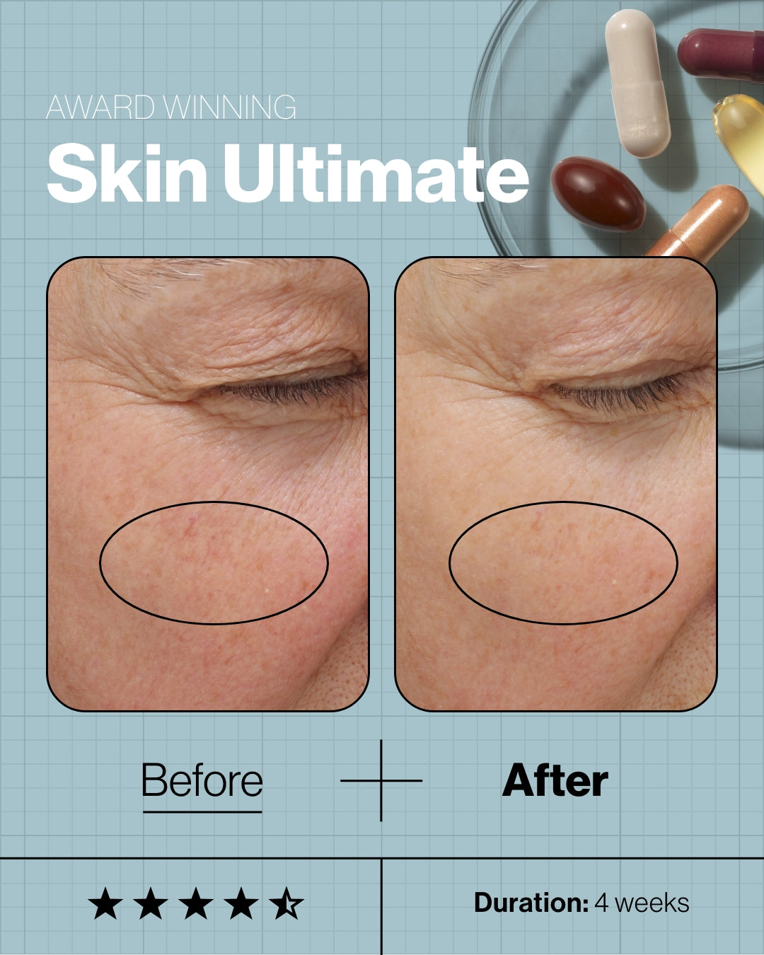 Skin Ultimate