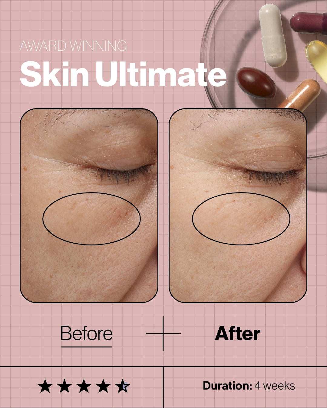 Skin Ultimate