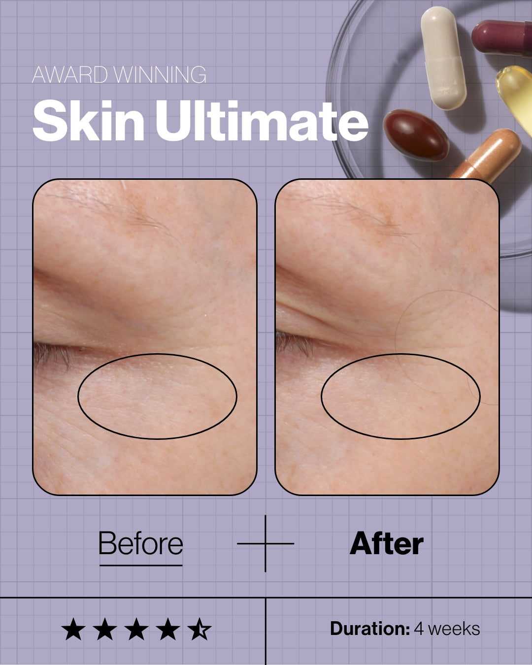Skin Ultimate