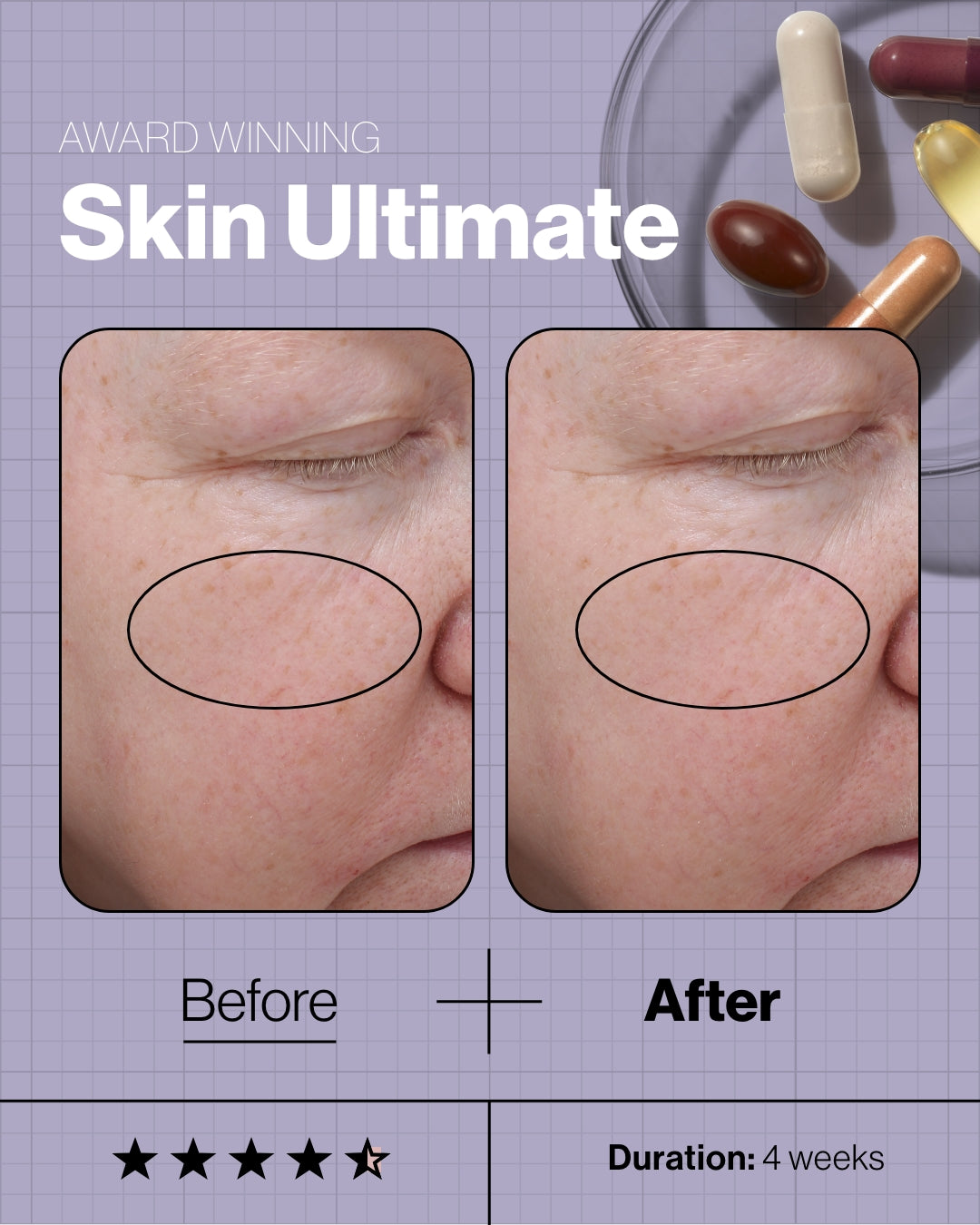 Skin Ultimate
