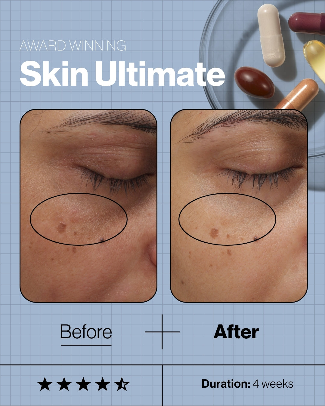 Skin Ultimate